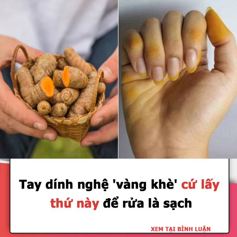 Tay dính nghệ ‘vàng khè’, cứ lấy thứ này để rửa là sạch