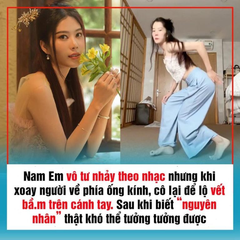 Nam Em vô tư nhảy theo nhạc nhưng khi xoay người về phía ống kính, cô lại để lộ vết bầ.m trên cánh tay. Sau khi biết “nguyên nhân” thật khó thể tưởng tưởng được