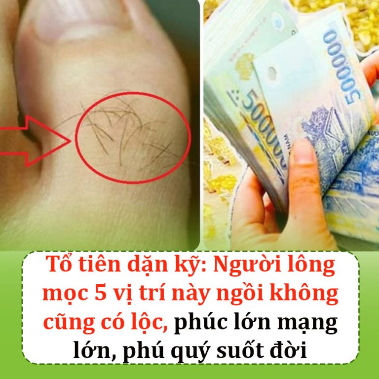 Tổ tiên dặn kỹ: Người lông mọc 5 vị trí này ngồi không cũng có lộc, phúc lớn mạng lớn, phú quý suốt đời