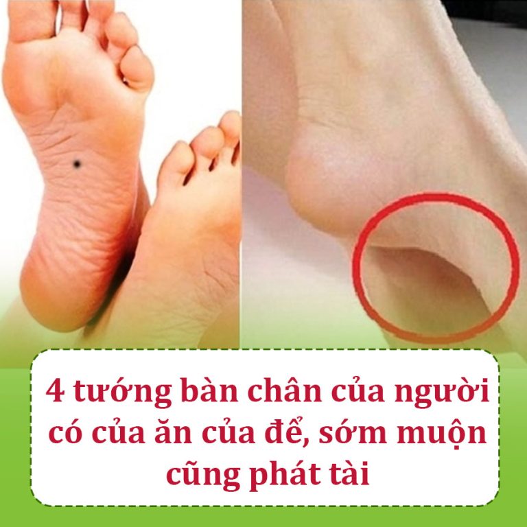 4 tướng bàn chân của người có của ăn của để, sớm muộn cũng phát tài