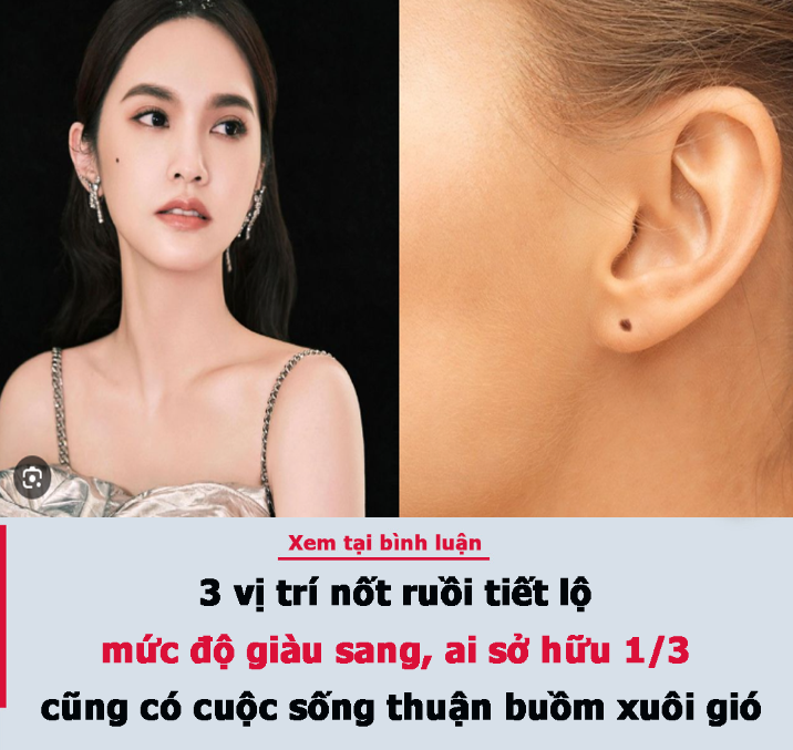 3 vị trí nốt ruồi tiết lộ mức độ giàu sang, ai sở hữu 1/3 cũng có cuộc sống thuận buồm xuôi gió