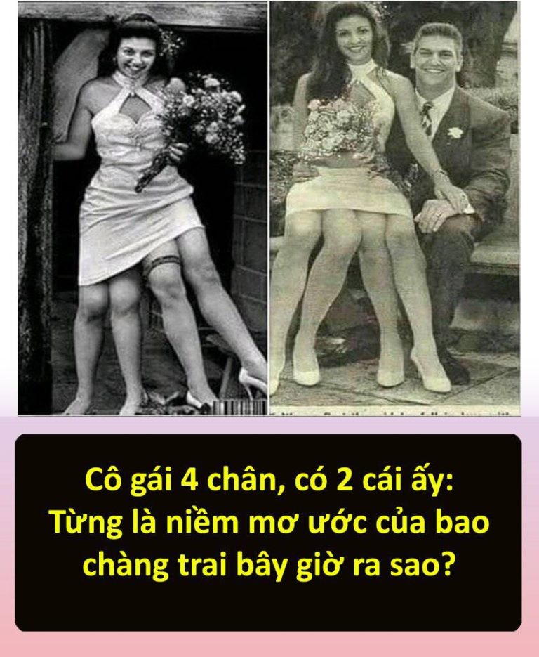 Cô gái 4 chân, có 2 cái ấy: Từng ʟà niềm mơ ước của bao chàng trai bây giờ ra sao?