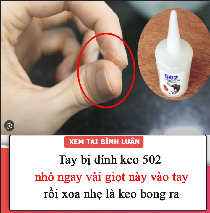 Tay bị dính keo 502, nhỏ ngay vài giọt này vào tay rồi xoa nhẹ là keo bong ra