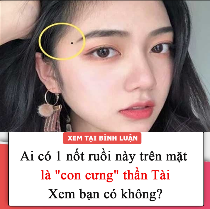 Ai có 1 nốt ruồi này trên mặt là “con cưng” thần Tài, xem bạn có không?