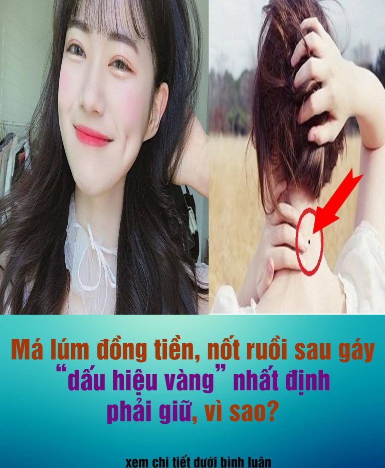 Các cụ dặn: “Má lúm đồng tiền, nốt ruồi trước ngực hay sau gáy nhớ phải giữ, bởi đó là ”kho tiền tả hữu”