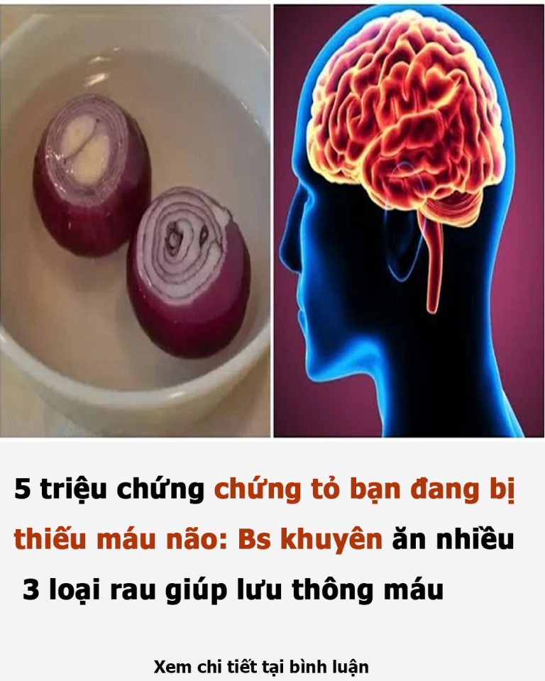 5 triệu chứng chứng tỏ bạn đang bị thiếu máu não: Bs khuyên ăn nhiều 3 loại rau giúp lưu thông máu