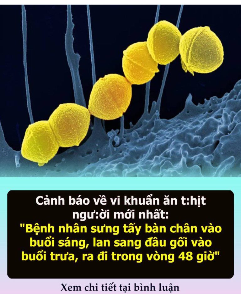 Giới y học lo ngại về vi khuẩn ăn thịt người tại Nhật Bản: “Bệnh nhân sưng tấy bàn chân vào buổi sáng, lan sang đầu gối vào buổi trưa, thiệt mạng trong vòng 48 giờ”