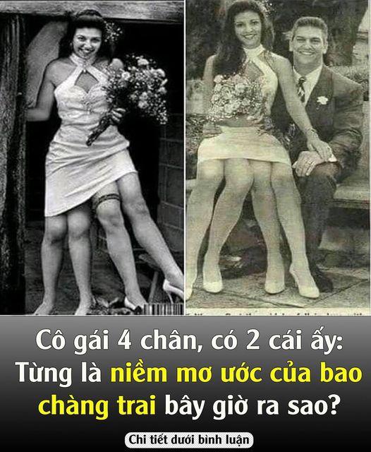 Cô gái 4 chân, có 2 cái ấy: Từng ʟà niềm mơ ước của bao chàng trai bây giờ ra sao?