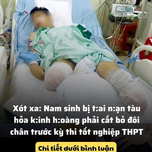 Xót xa: Nam sinh bị t:ai n:ạn tàu hỏa k:inh h:oàng phải cắt bỏ đôi chân trước kỳ thi tốt nghiệp THPT