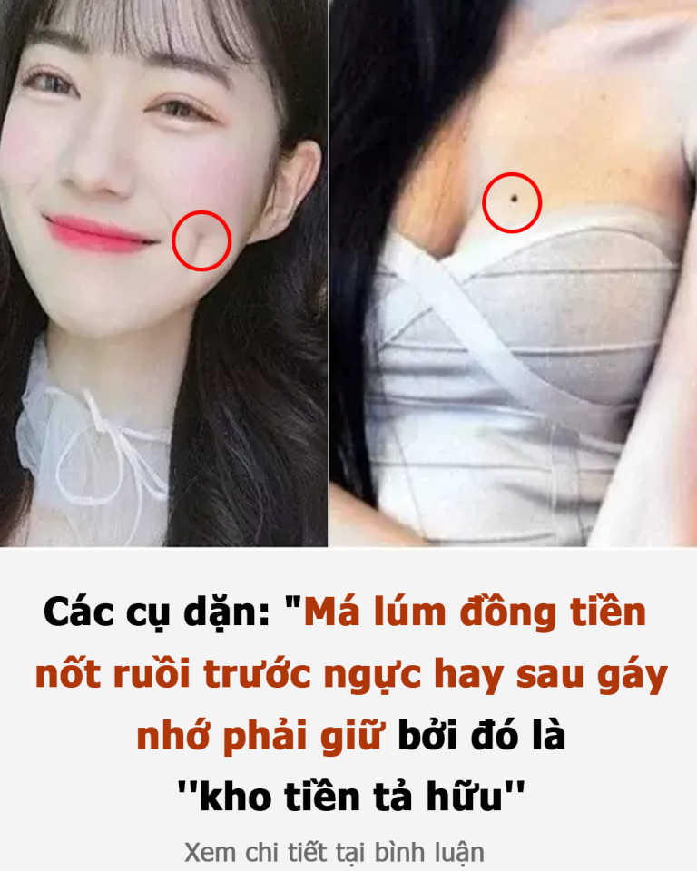 Các cụ dặn: “Má lúm đồng tiền, nốt ruồi trước ngực hay sau gáy nhớ phải giữ, bởi đó là ”kho tiền tả hữu”