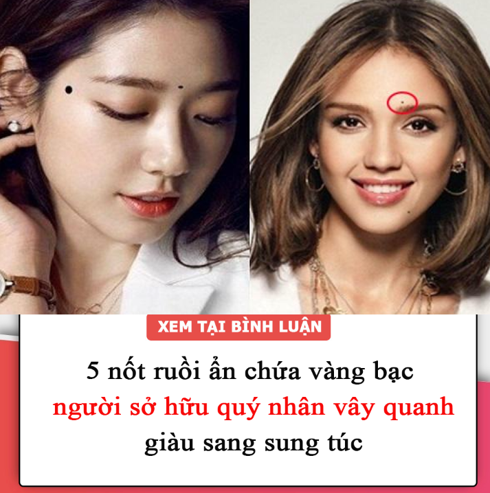 5 nốt ruồi ẩn chứa vàng bạc, người sở hữu quý nhân vây quanh, giàu sang sung túc