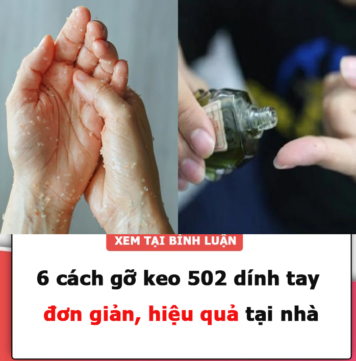 6 cách gỡ keo 502 dính tay đơn giản, hiệu quả tại nhà