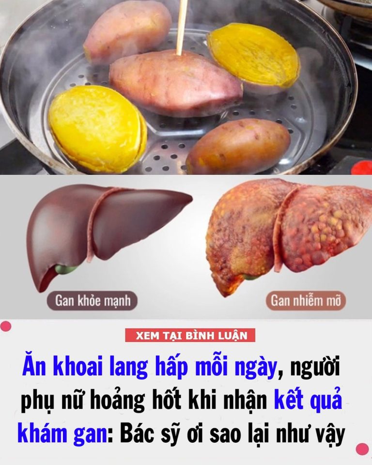 Ăn khoai lang hấp mỗi ngày, người phụ nữ hoảng hốt khi nhận kết quả khám gan: Sao lại như vậy được