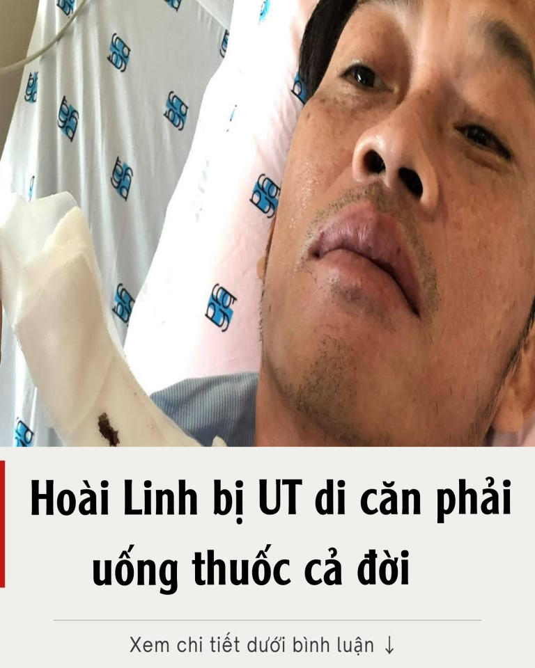 Hoài Linh bị UT d;i c;ăn phải uống thuốc cả đời