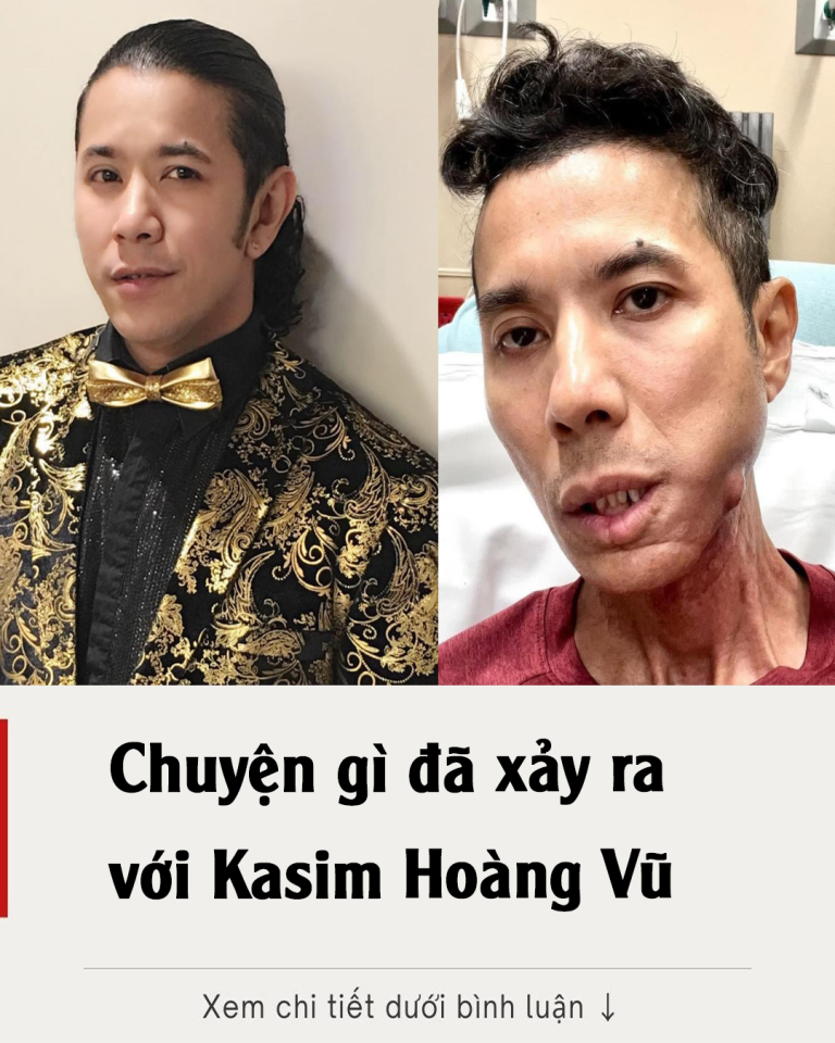 Chuyện gì đã xảy ra với Kasim Hoàng Vũ?