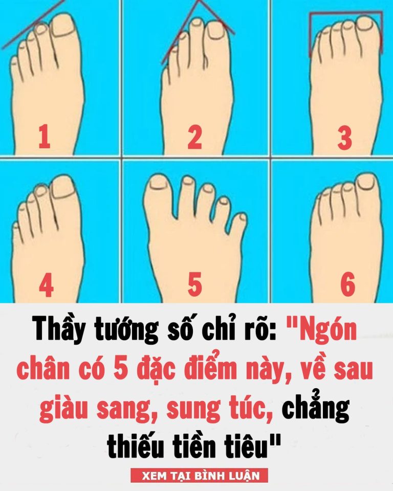 Thầy tướng số chỉ rõ: “Ngón chân có 5 đặc điểm này, về sau giàu sang, sung túc, chẳng thiếu tiền tiêu”